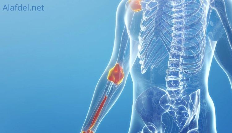 صورة بها جزء من شكل الإنسان وذلك ضمن الأسباب التي تؤدي للإصابة بهشاشة العظام Osteoporosis