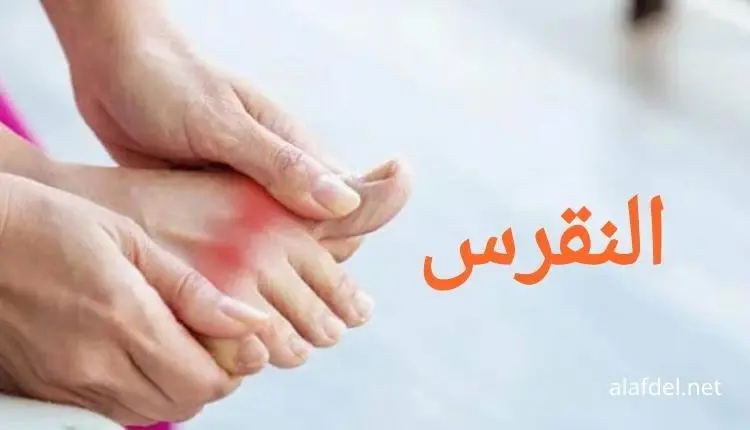 صورة بها شخص يمسك رجله ومكتوب على الصورة ما هو النقرس What-is-gout