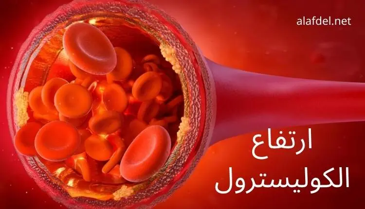 صورة بها قطاع في أحد الأوردة ضمن الحديث عن ارتفاع الكوليسترول high-cholesterol