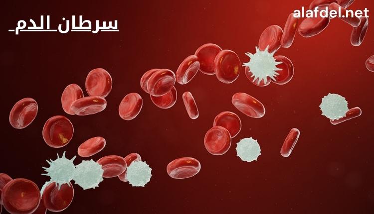 صورة تحت المجهر يظهر بها شكل خلايا دم سليمة ومصابة ضمن الحديث عن سرطان الدم blood cancer