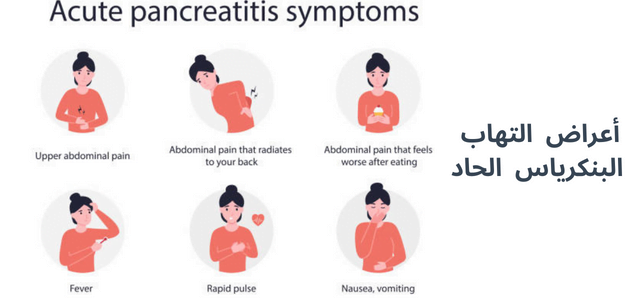 صورة بها رسومات توضيحية لسيدة تعاني من أعراض التهاب البنكرياس الحاد