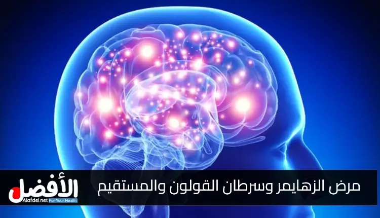 أدلة على العلاقة العكسية بين الإصابة بمرض الزهايمر وسرطان القولون والمستقيم