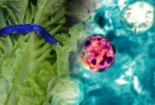 Cyclospora